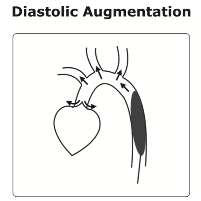 diastolic augmentation