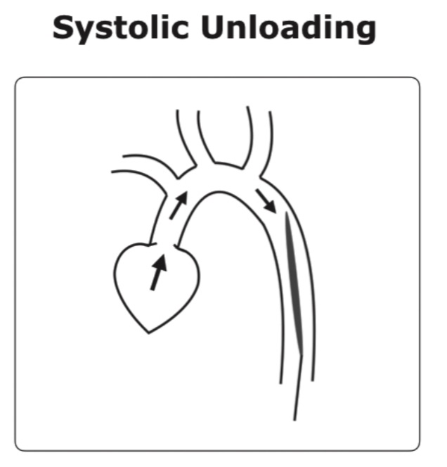 systolic unloading